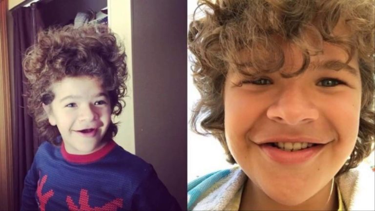 Como ator da série ‘Stranger Things’ se tornou exemplo para pessoas com doença rara