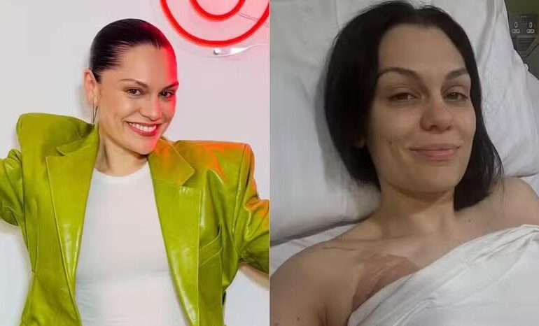 Jessie J fala sobre diagnóstico de câncer, nova cirurgia e seu retorno à música