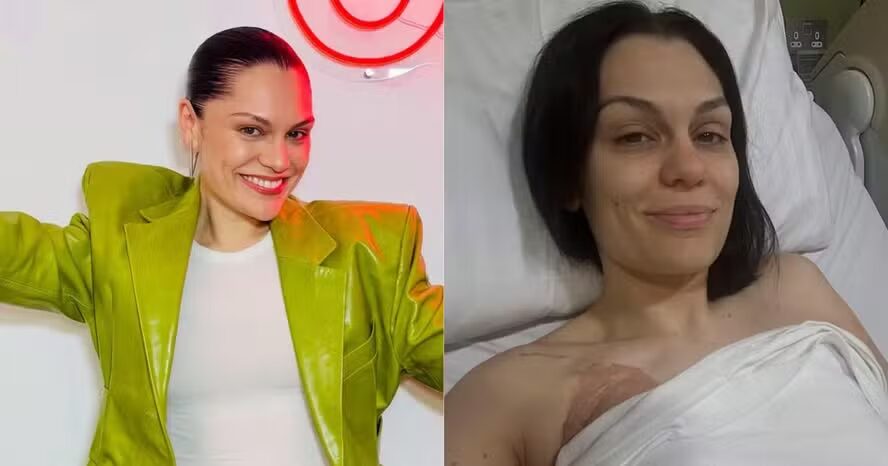 Jessie J fala sobre diagnóstico de câncer, nova cirurgia e seu retorno à música
